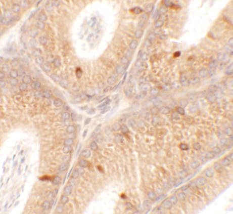 Immunohistochemistry: SPATA4 Antibody - BSA Free [NBP2-81852] - Immunohistochemistry of SPATA4 in mouse testis tissue with SPATA4 antibody at 2.5 ug/mL.