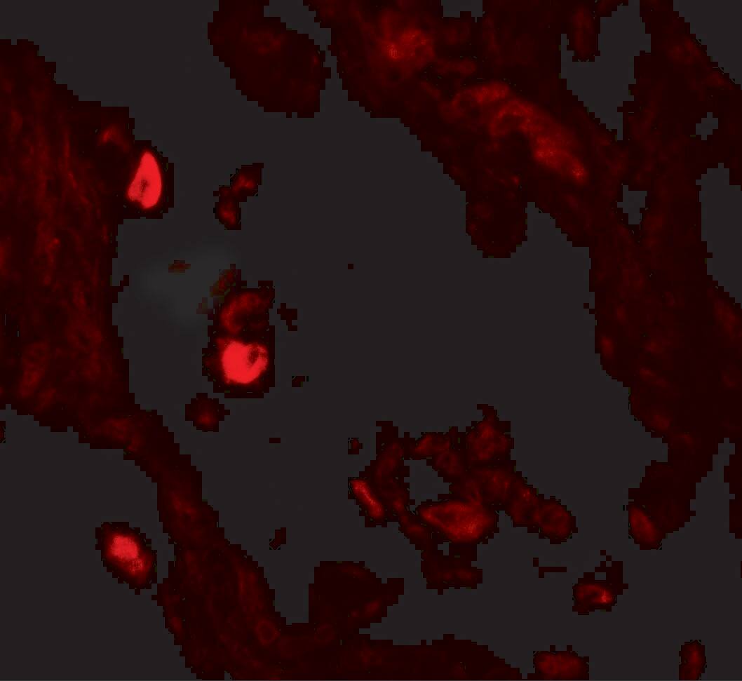 Immunocytochemistry/ Immunofluorescence: Leucyl-cystinyl Aminopeptidase/LNPEP Antibody - BSA Free [NBP2-81854] - Immunofluorescence of Leucyl-cystinyl Aminopeptidase/LNPEP in human lung tissue with Leucyl-cystinyl Aminopeptidase/LNPEP antibody at 20 u/mL.