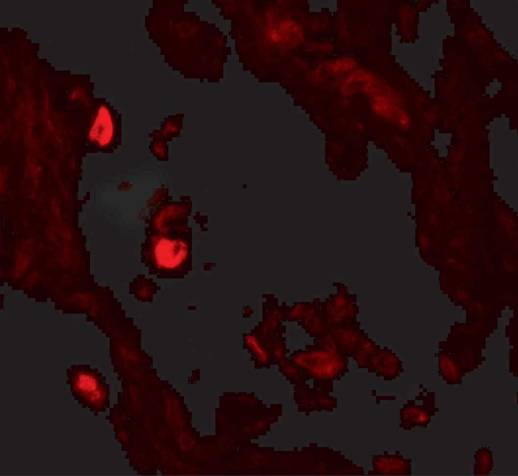 Immunocytochemistry/ Immunofluorescence Leucyl-cystinyl Aminopeptidase/LNPEP Antibody - BSA Free