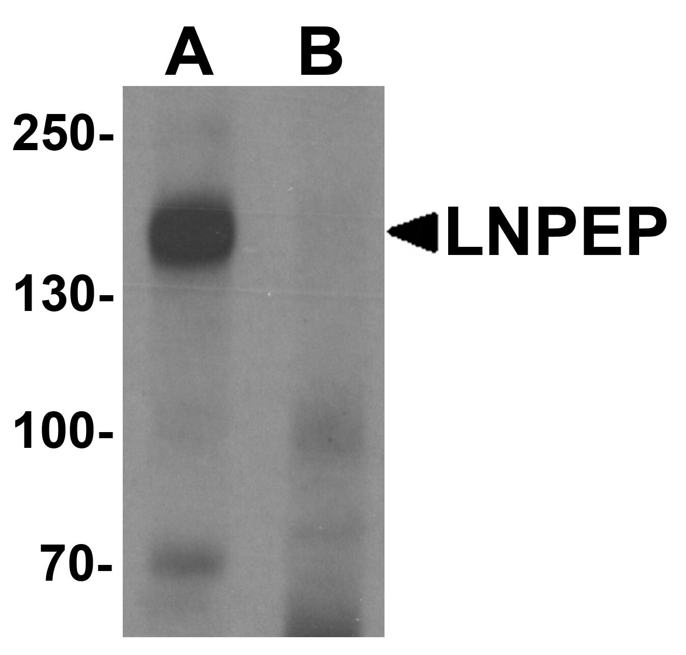 Western Blot: Leucyl-cystinyl Aminopeptidase/LNPEP Antibody - BSA Free [NBP2-81854] - Western blot analysis of Leucyl-cystinyl Aminopeptidase/LNPEP in human lung tissue lysate with Leucyl-cystinyl Aminopeptidase/LNPEP antibody at 1 u/mL in (A) the absence and (B) the presence of blocking peptide.