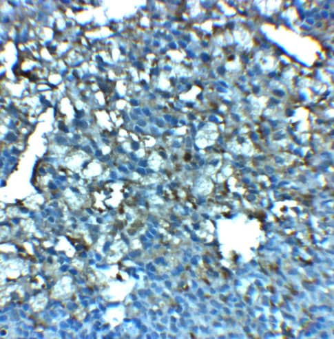 Immunohistochemistry: LRRC8A Antibody - BSA Free [NBP2-81855] - Immunohistochemistry of LRRC8A in rat spleen tissue with LRRC8A antibody at 2.5 ug/mL.
