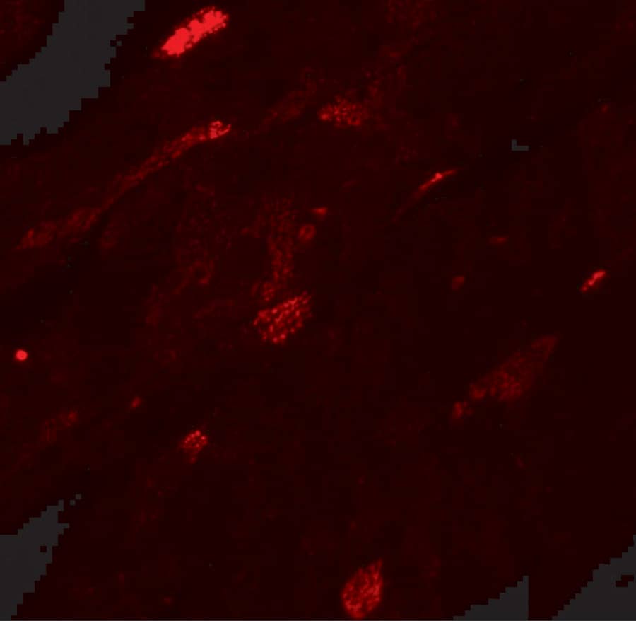 Immunocytochemistry/ Immunofluorescence: Transglutaminase 5 Antibody - BSA Free [NBP2-81857] - Immunofluorescence of Transglutaminase 5 in mouse heart tissue with Transglutaminase 5 antibody at 20 u/mL.