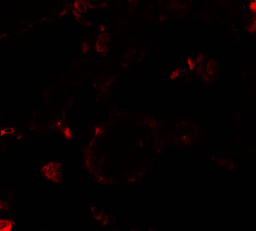 Immunocytochemistry/ Immunofluorescence: VKORC1 Antibody - BSA Free [NBP2-81859] - Immunofluorescence of VKORC1 in human lung tissue with VKORC1 antibody at 20 ug/mL.