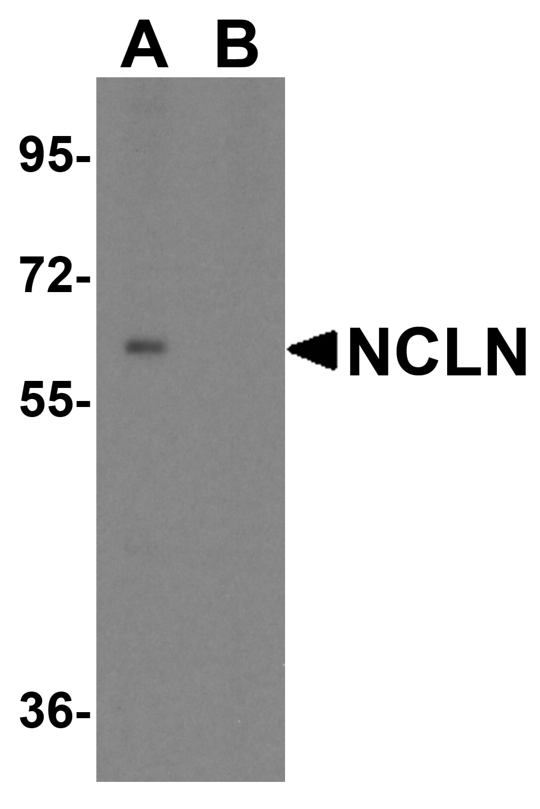 Western Blot: Nicalin Antibody - BSA Free [NBP2-81860] - Western blot analysis of Nicalin in mouse heart tissue lysate with Nicalin antibody at 0.5 ug/mL in (A) the absence and (B) the presence of blocking peptide.