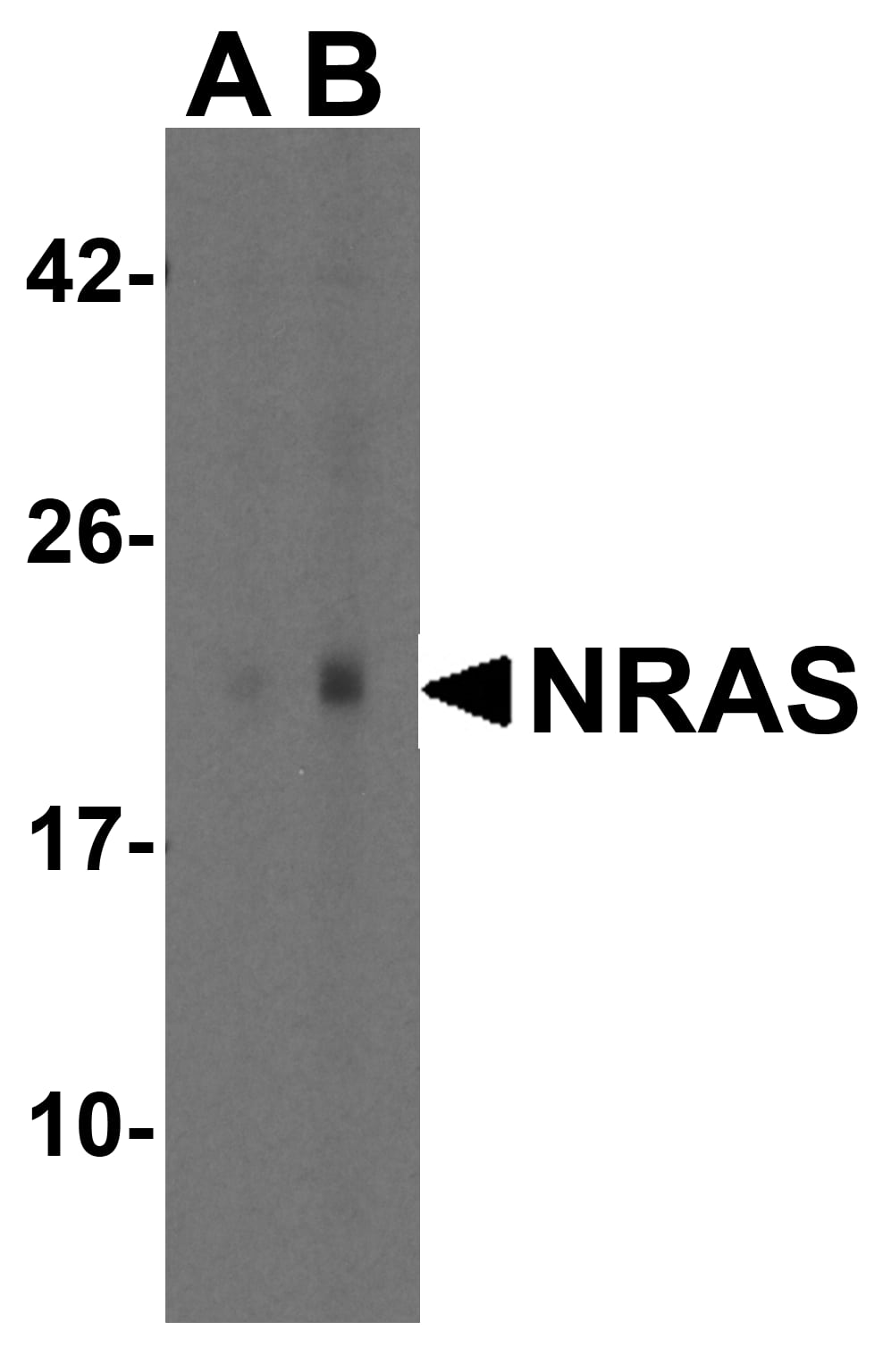 Western Blot: NRAS Antibody - BSA Free [NBP2-81861] - Western blot analysis of NRAS in A431 cell lysate with NRAS antibody at (A) 1 and (B) 2 u/mL.