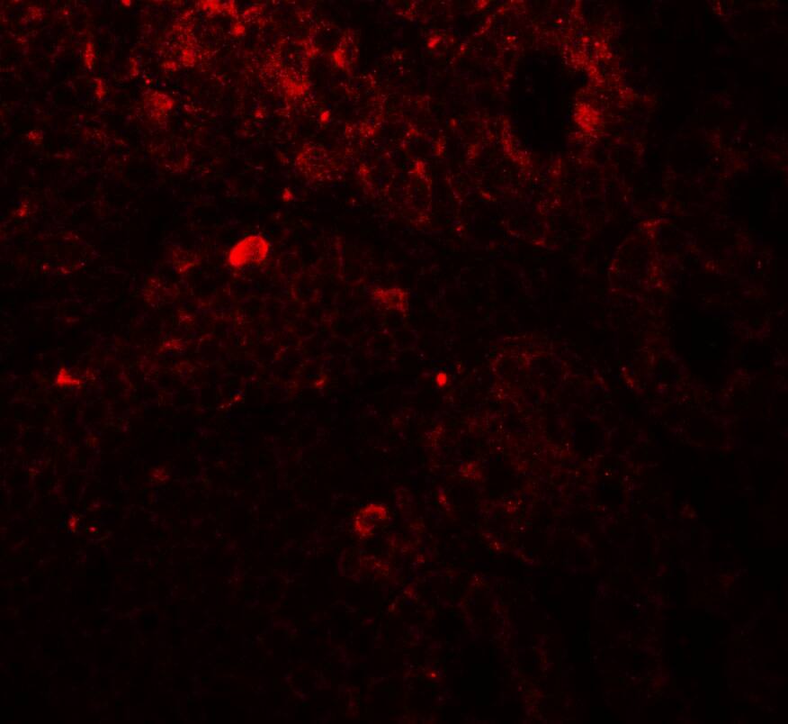 Immunocytochemistry/ Immunofluorescence: Thyroid receptor-interacting protein 12 Antibody - BSA Free [NBP2-81864] - Immunofluorescence of Thyroid receptor-interacting protein 12 in rat colon tissue with Thyroid receptor-interacting protein 12 antibody at 20 ug/ml.