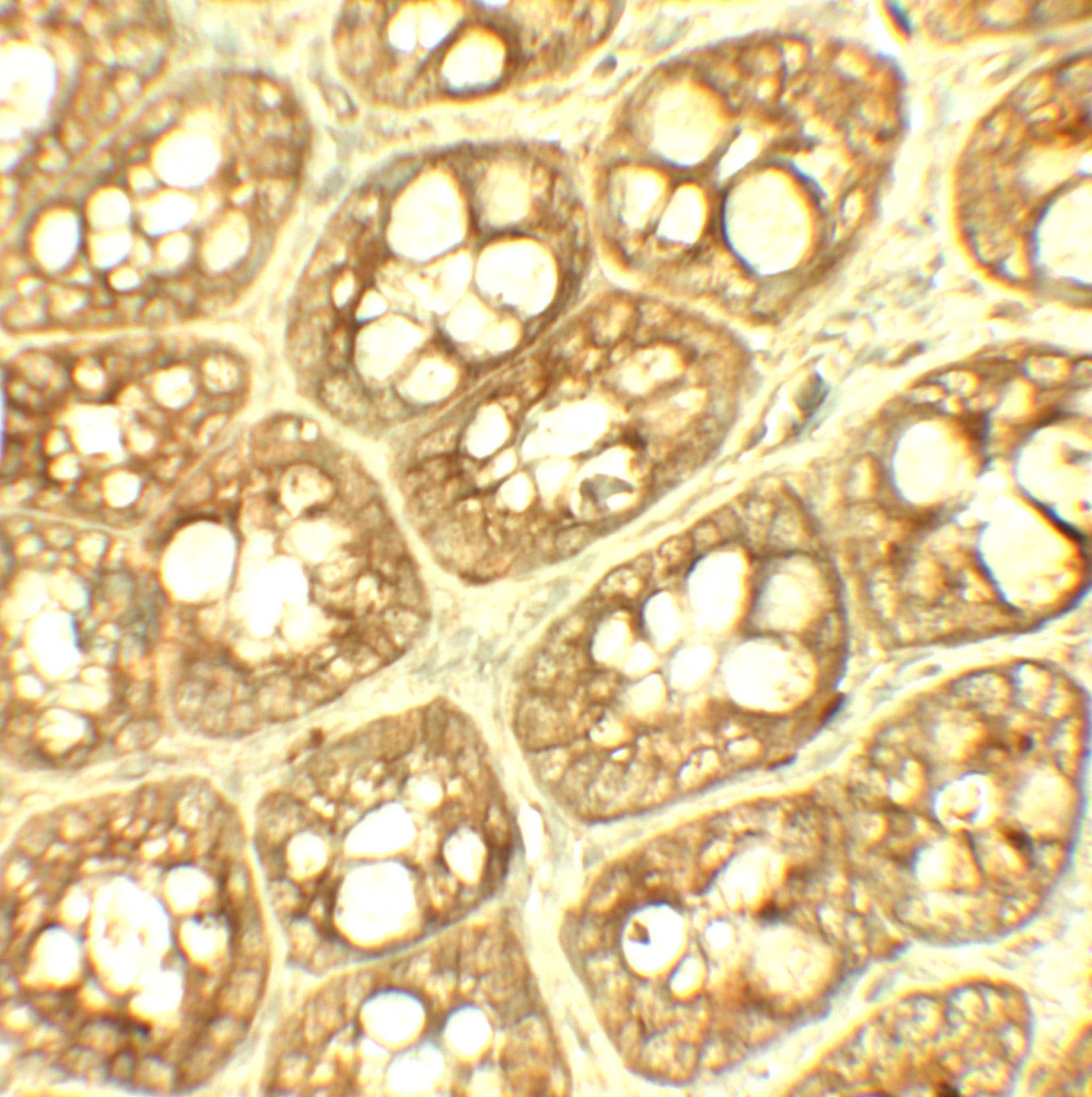 Immunohistochemistry: Thyroid receptor-interacting protein 12 Antibody - BSA Free [NBP2-81864] - Immunohistochemistry of Thyroid receptor-interacting protein 12 in rat colon tissue with Thyroid receptor-interacting protein 12 antibody at 5 ug/ml.