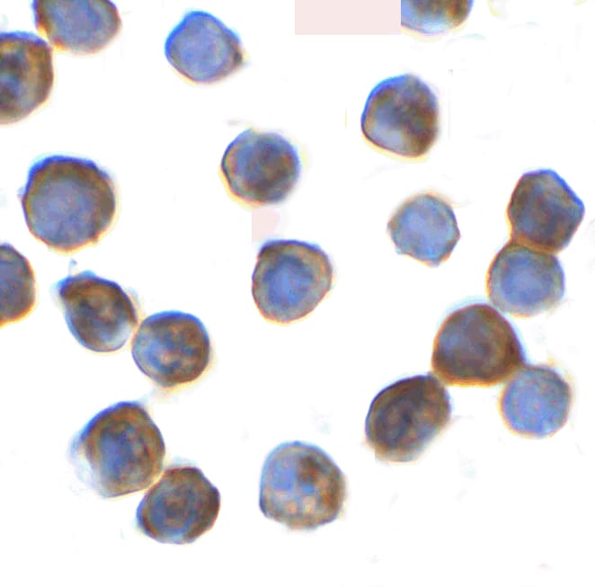 Immunocytochemistry/ Immunofluorescence: Thyroid receptor-interacting protein 12 Antibody - BSA Free [NBP2-81864] - Immunocytochemistry of Thyroid receptor-interacting protein 12 in Hela cells with Thyroid receptor-interacting protein 12 Antibody at 2 ug/ml.