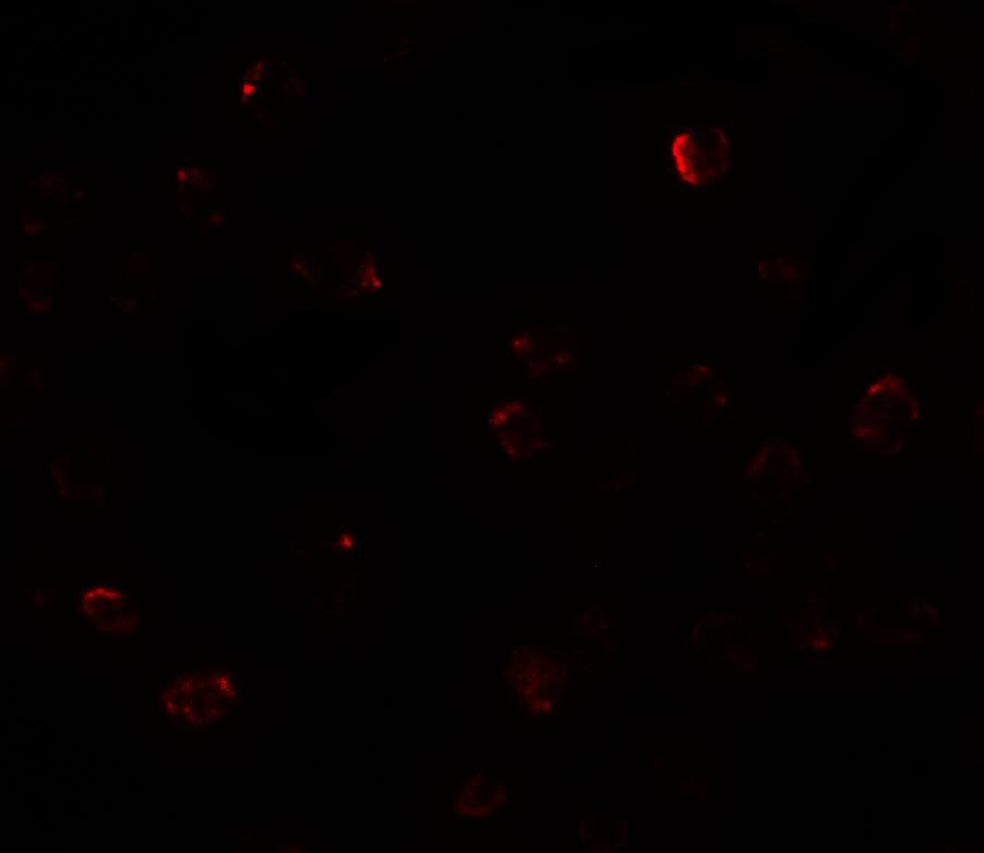 Immunocytochemistry/ Immunofluorescence: ZBTB40 Antibody - BSA Free [NBP2-81868] - Immunofluorescence of ZBTB40 in Raji cells with ZBTB40 antibody at 20 ug/mL.
