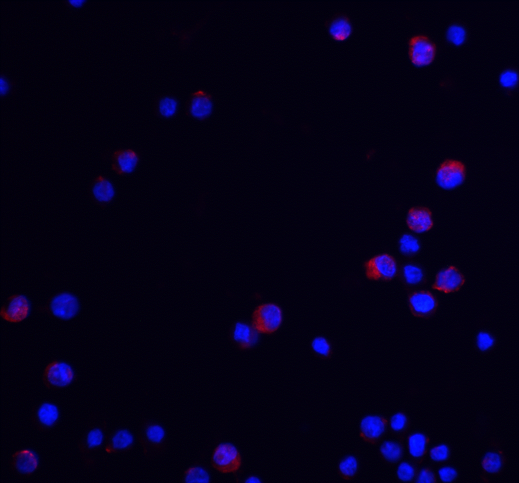 Immunocytochemistry/ Immunofluorescence: UBAP2L Antibody - BSA Free [NBP2-81871] - Immunofluorescence of UBAP2L in HeLa cells with UBAP2L antibody at 20 ug/ml.Red: UBAP2L Antibody   Blue: DAPI staining
