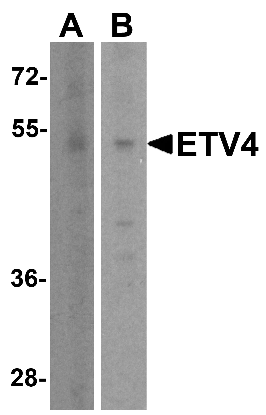 Western Blot: Pea3 Antibody - BSA Free [NBP2-81873] - Western blot analysis of Pea3 in (A) human brain tissue lysate and (B) A431 cell lysate with Pea3 antibody at 1 u/ml.