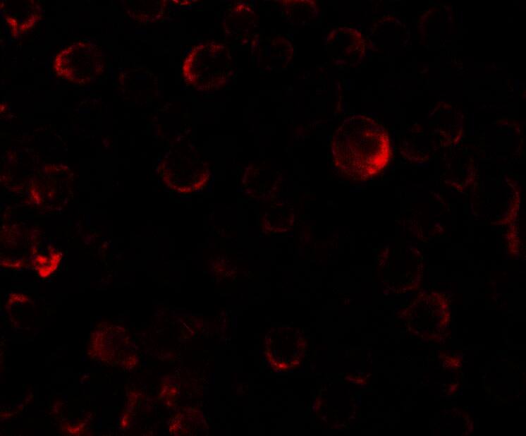 Immunocytochemistry/ Immunofluorescence: PHLPP2 Antibody - BSA Free [NBP2-81874] - Immunofluorescence of PHLPP2 in SW480 cells with PHLPP2 antibody at 5 ug/ml.