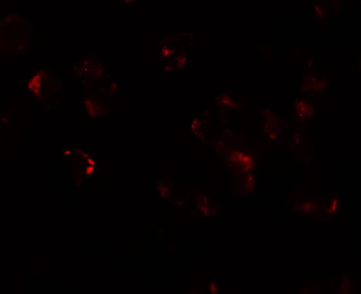 Immunocytochemistry/ Immunofluorescence: AFAP1L1 Antibody - BSA Free [NBP2-81889] - Immunofluorescence of AFAP1L1 in A549 cells with AFAP1L1 antibody at 20 u/mL.
