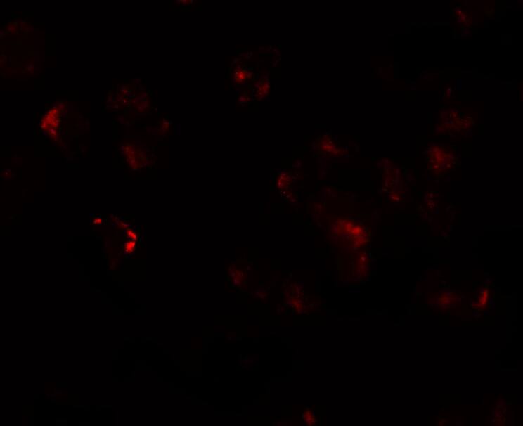 Immunocytochemistry/ Immunofluorescence: AFAP1L1 Antibody - BSA Free [NBP2-81889] - Immunofluorescence of AFAP1L1 in A549 cells with AFAP1L1 antibody at 20 u/mL.