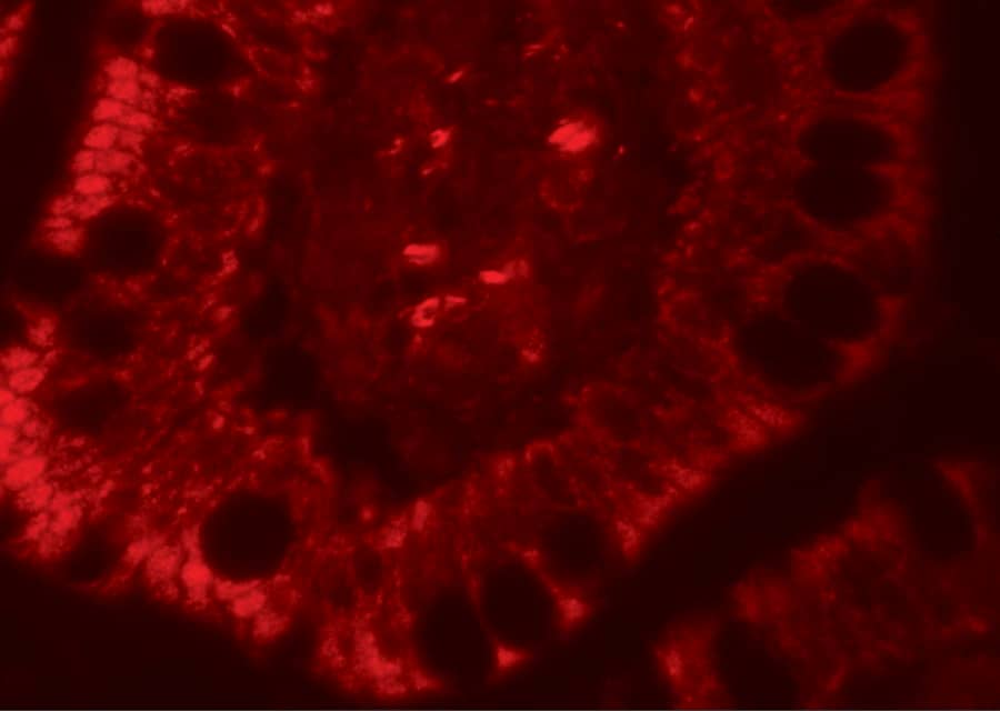 Immunocytochemistry/ Immunofluorescence Roquin Antibody - BSA Free