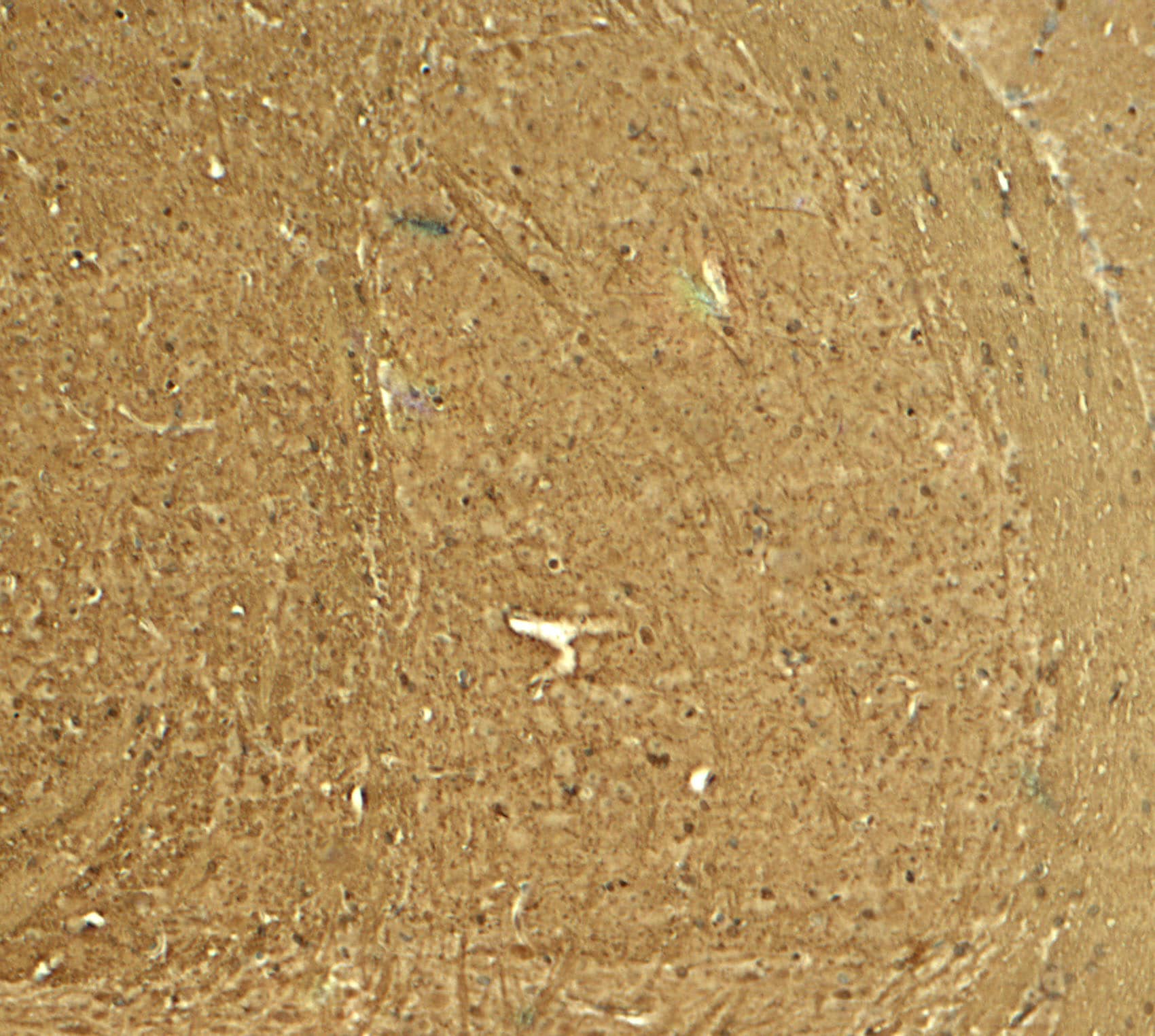 Immunohistochemistry: STEP Antibody - BSA Free [NBP2-81893] - Immunohistochemistry of STEP in mouse brain tissue with STEP antibody at 5 u/ml.