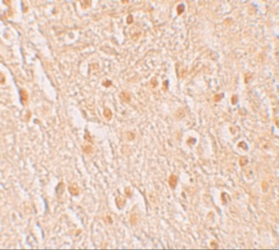 Immunohistochemistry: GSAP Antibody - BSA Free [NBP2-81894] - Immunohistochemistry of GSAP in human brain tissue with GSAP antibody at 5 u/mL.