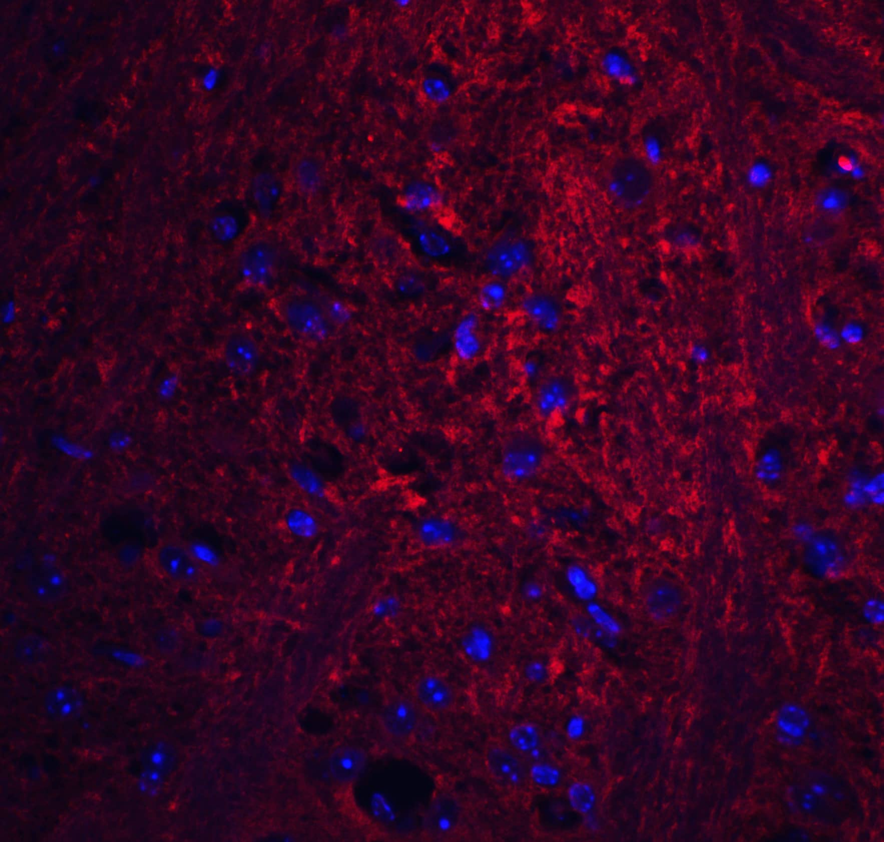 Immunocytochemistry/ Immunofluorescence: GSAP Antibody - BSA Free [NBP2-81894] - Immunofluorescence of GSAP in mouse brain tissue with GSAP antibody at 20 u/mL.Red: GSAP Antibody   Blue: DAPI staining