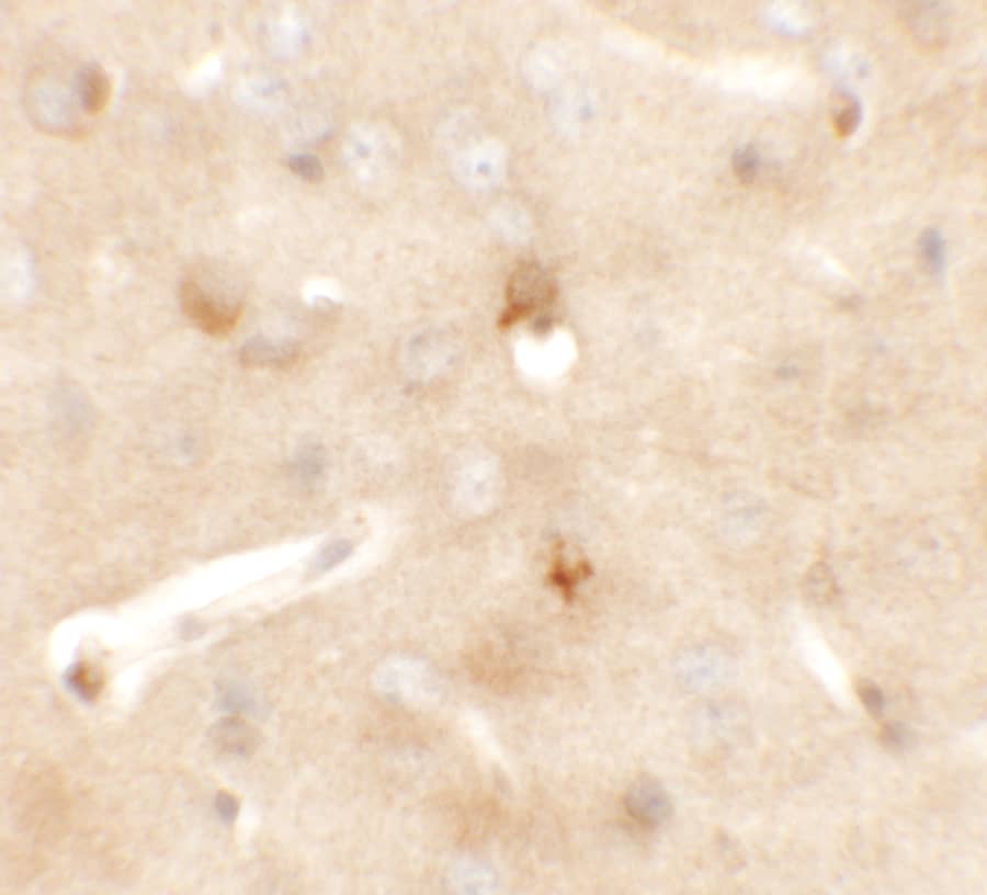 Immunohistochemistry CCDC141 Antibody - BSA Free