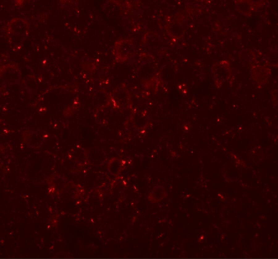 Immunocytochemistry/ Immunofluorescence CCDC141 Antibody - BSA Free