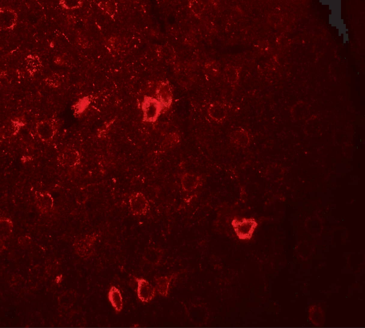 Immunocytochemistry/ Immunofluorescence CNRIP1 Antibody - BSA Free