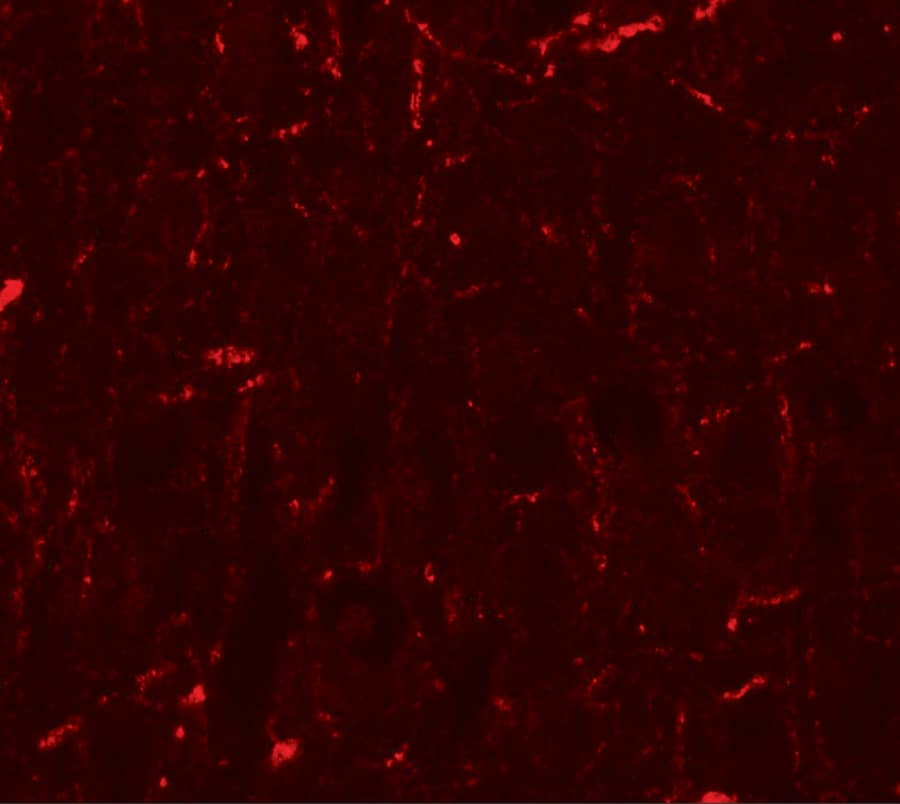 Immunocytochemistry/ Immunofluorescence: Cyclin T1 Antibody - BSA Free [NBP2-81898] - Immunofluorescence of Cyclin T1 in rat brain tissue with Cyclin T1 antibody at 20 ug/ml.