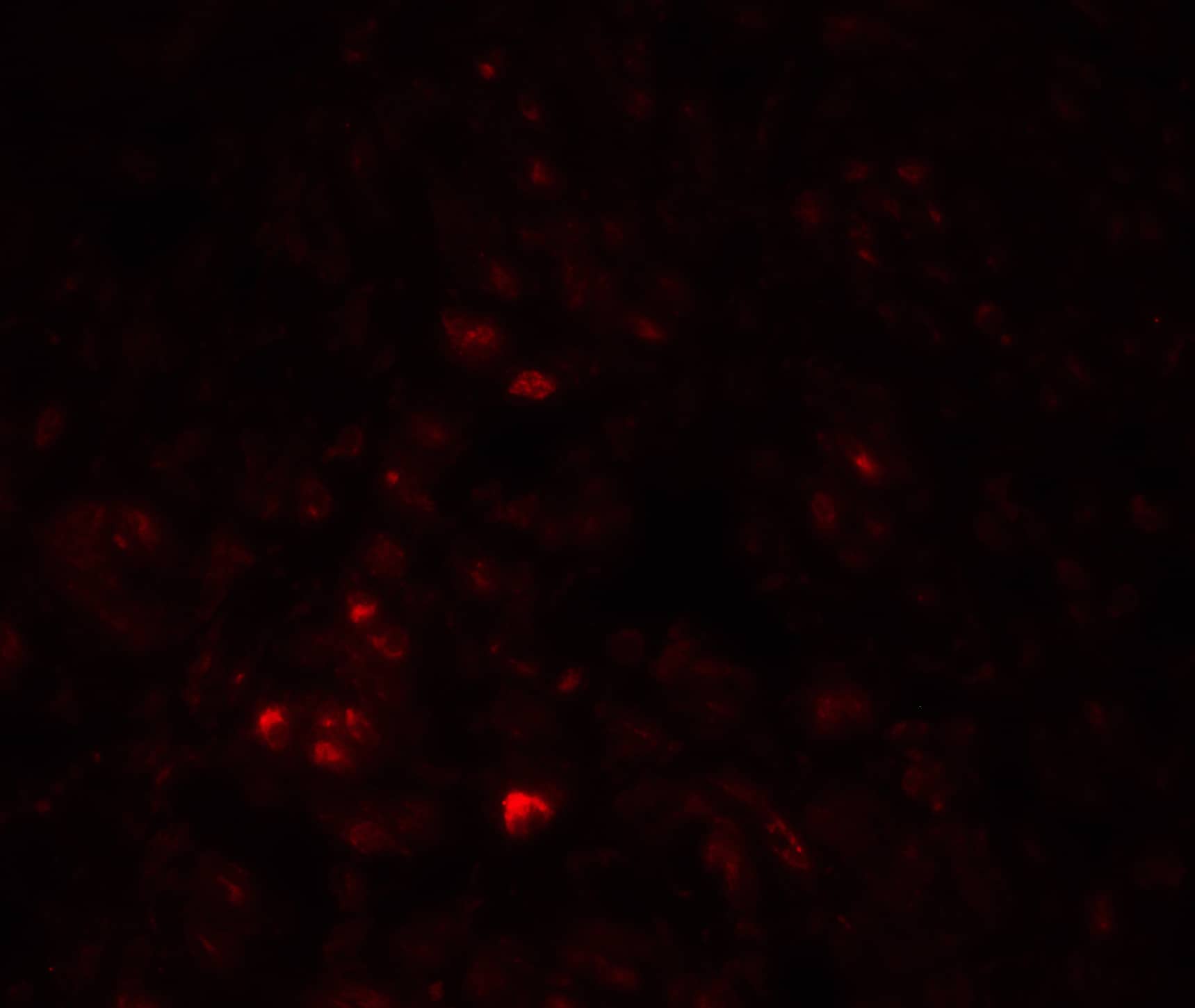 Immunocytochemistry/ Immunofluorescence: CAPC / LRRC26 Antibody - BSA Free [NBP2-81900] - Immunofluorescence of CAPC / LRRC26 in human prostate tissue with CAPC / LRRC26 Antibody at 20 ug/mL.