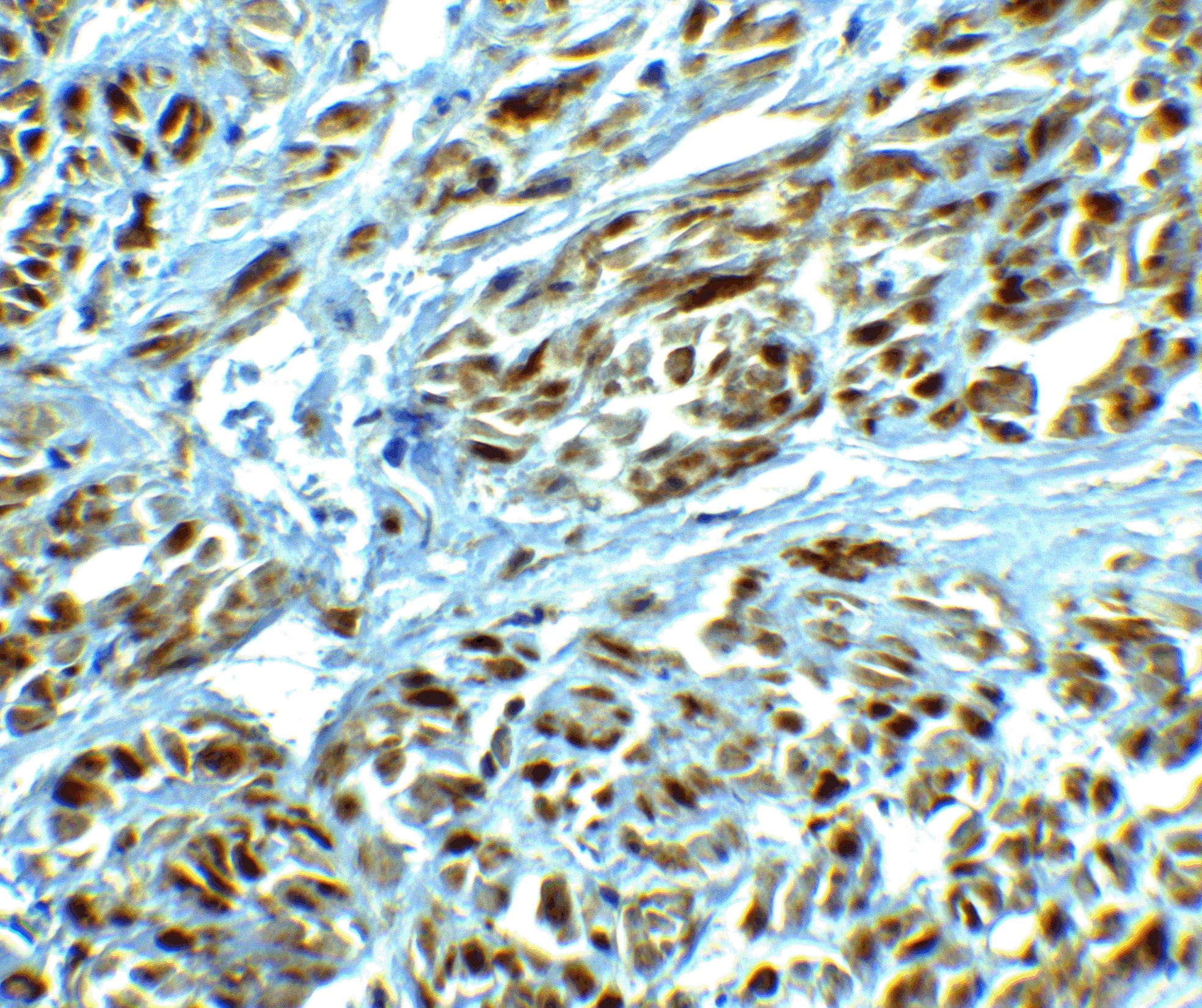 Immunohistochemistry: CAPC / LRRC26 Antibody - BSA Free [NBP2-81900] - Immunohistochemistry of CAPC / LRRC26 in human prostate tissue with CAPC / LRRC26 antibody at 2.5 ug/ml.