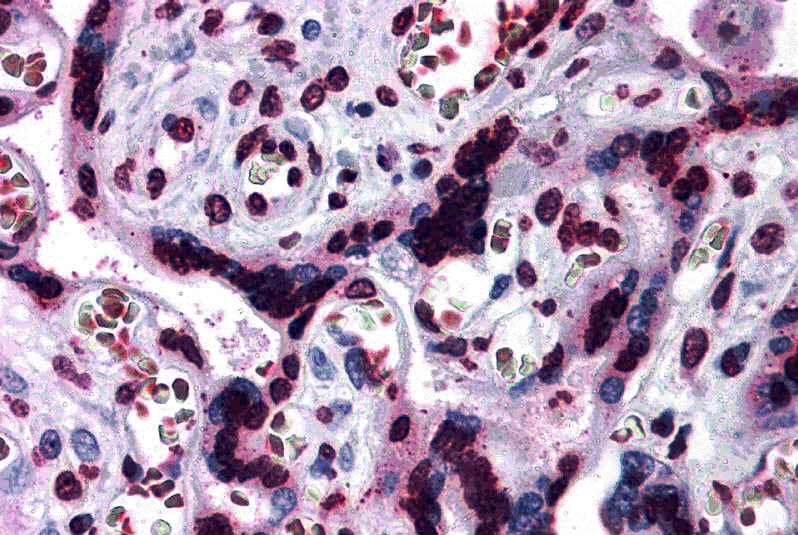 Immunohistochemistry: CARD14 Antibody - BSA Free [NBP2-81901] - Immunohistochemistry of CARD14 in human placenta tissue with CARD14 antibody at 5 ug/mL.