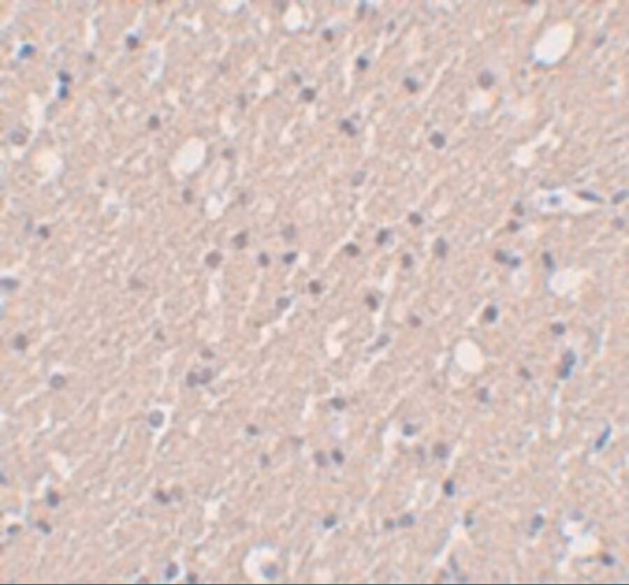 Immunohistochemistry: SIPA1L3 Antibody - BSA Free [NBP2-81902] - Immunohistochemistry of SIPA1L3 in human brain tissue with SIPA1L3 antibody at 5 ug/mL.