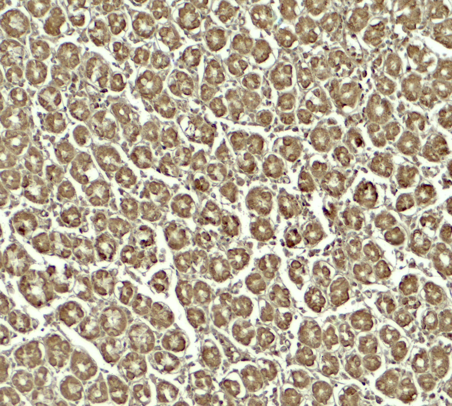 Immunohistochemistry SKIV2L Antibody - BSA Free