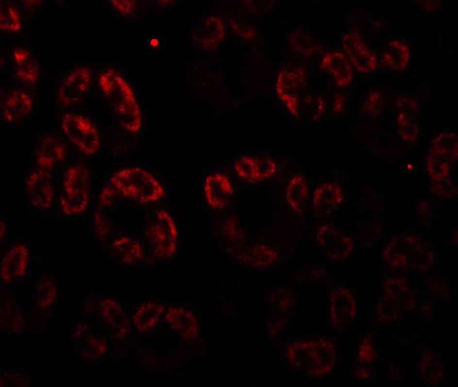 Immunocytochemistry/ Immunofluorescence SKIV2L Antibody - BSA Free