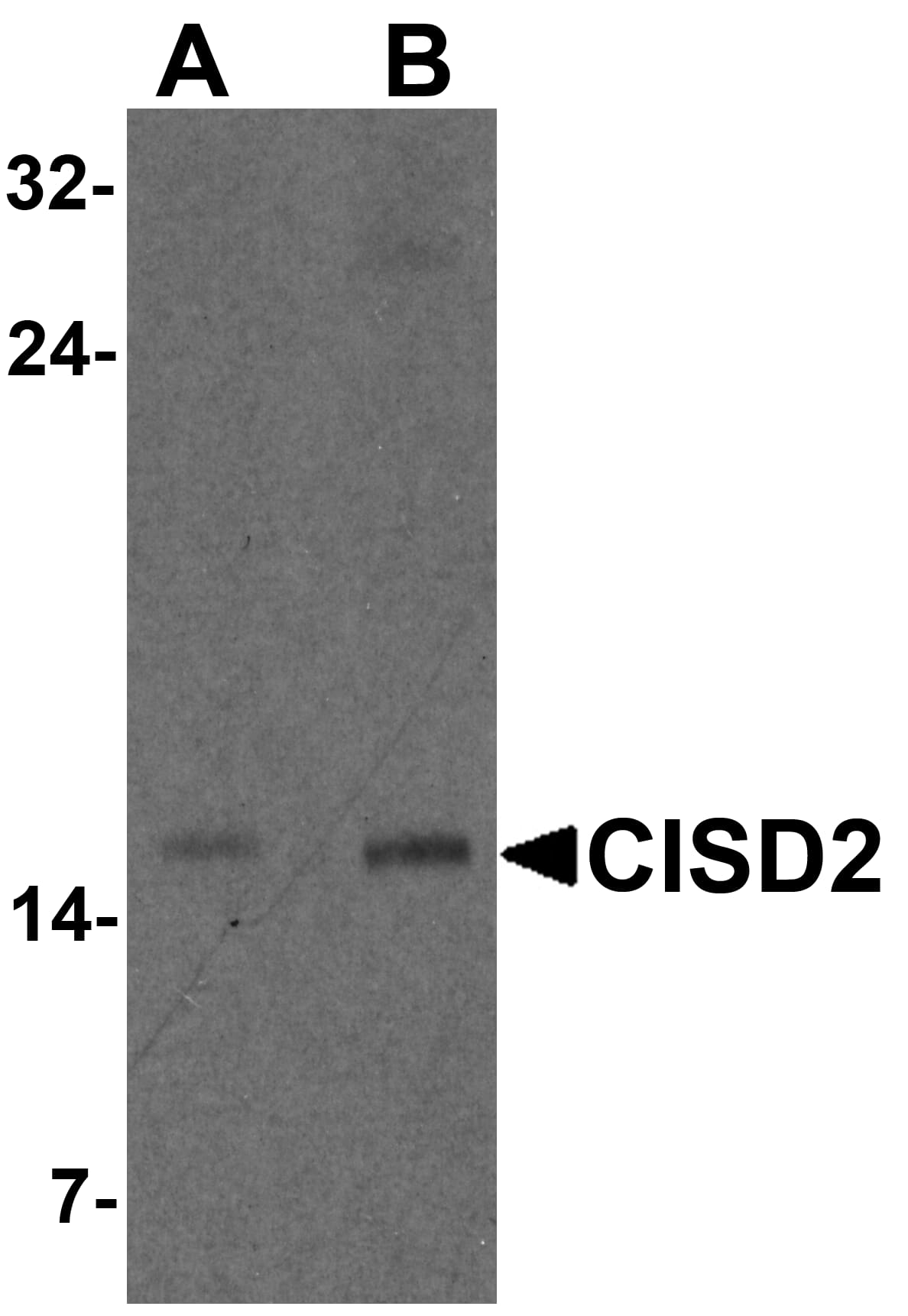 Western Blot: CISD2 Antibody - BSA Free [NBP2-81907] - Western blot analysis of CISD2 in rat brain tissue lysate with CISD2 antibody at (A) 1 and (B) 2 u/m