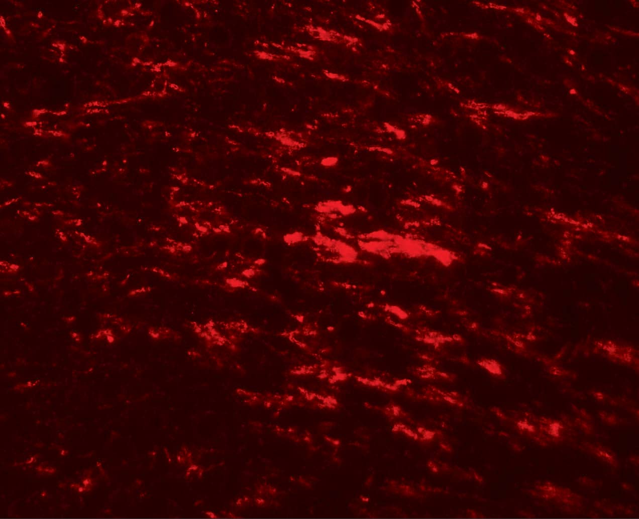 Immunocytochemistry/ Immunofluorescence: CISD2 Antibody - BSA Free [NBP2-81907] - Immunofluorescence of CISD2 in rat brain tissue with CISD2 antibody at 20 u/ml.