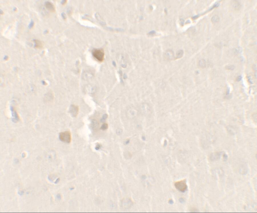 Immunohistochemistry: CISD2 Antibody - BSA Free [NBP2-81907] - Immunohistochemistry of CISD2 in rat brain tissue with CISD2 antibody at 2.5 u/ml.