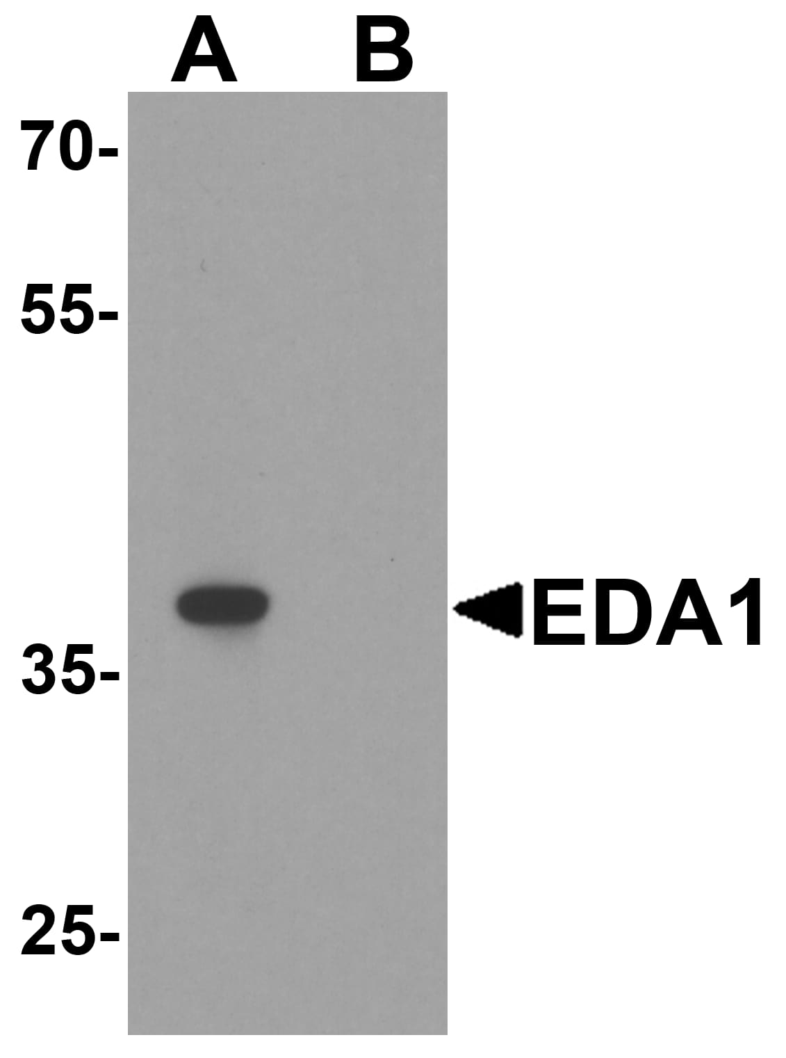 Western Blot: EDA-A1/Ectodysplasin A1 Antibody - BSA Free [NBP2-81908] - Western blot analysis of EDA-A1/Ectodysplasin A1 in mouse kidney tissue lysate with EDA-A1/Ectodysplasin A1 antibody at 1 u/ml in (A) the absence and (B) the presence of blocking peptide.