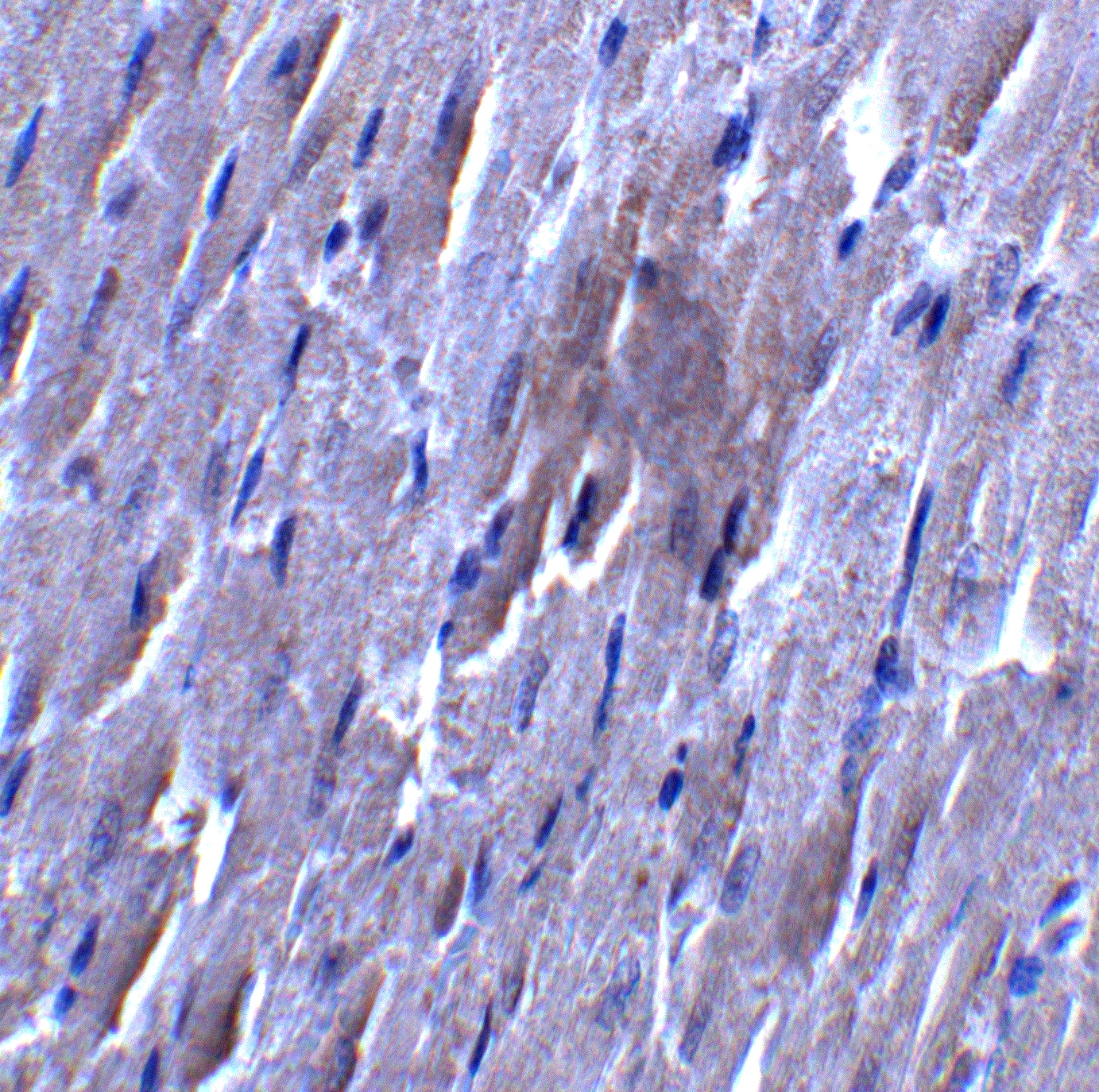 Immunohistochemistry: FATP6/SLC27A6 Antibody - BSA Free [NBP2-81909] - Immunocytochemistry of FATP6/SLC27A6 in rat heart tissue with FATP6/SLC27A6 antibody at 5 u/mL.