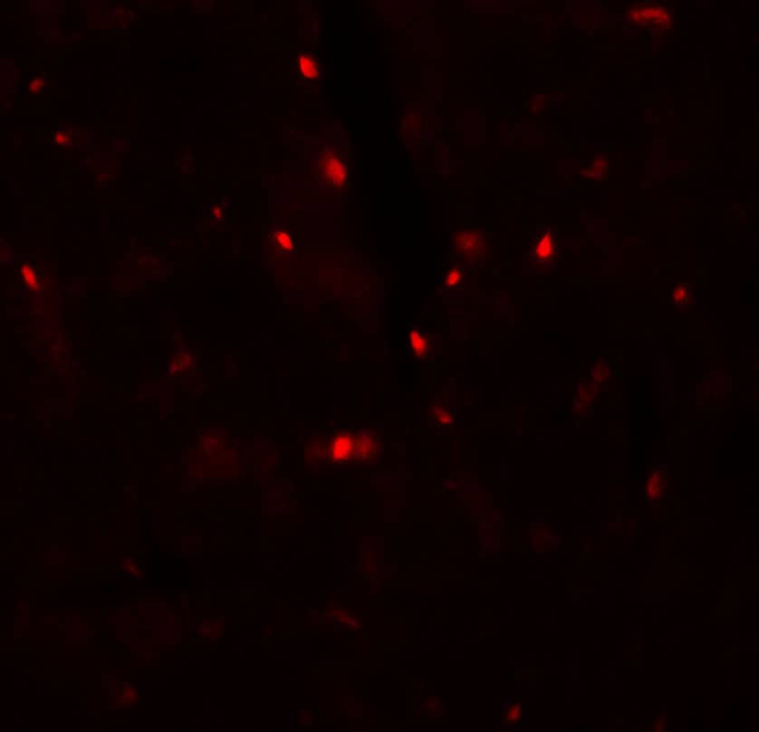 Immunocytochemistry/ Immunofluorescence: FATP6/SLC27A6 Antibody - BSA Free [NBP2-81909] - Immunofluorescence of FATP6/SLC27A6 in rat heart tissue with FATP6/SLC27A6 antibody at 20 u/mL.