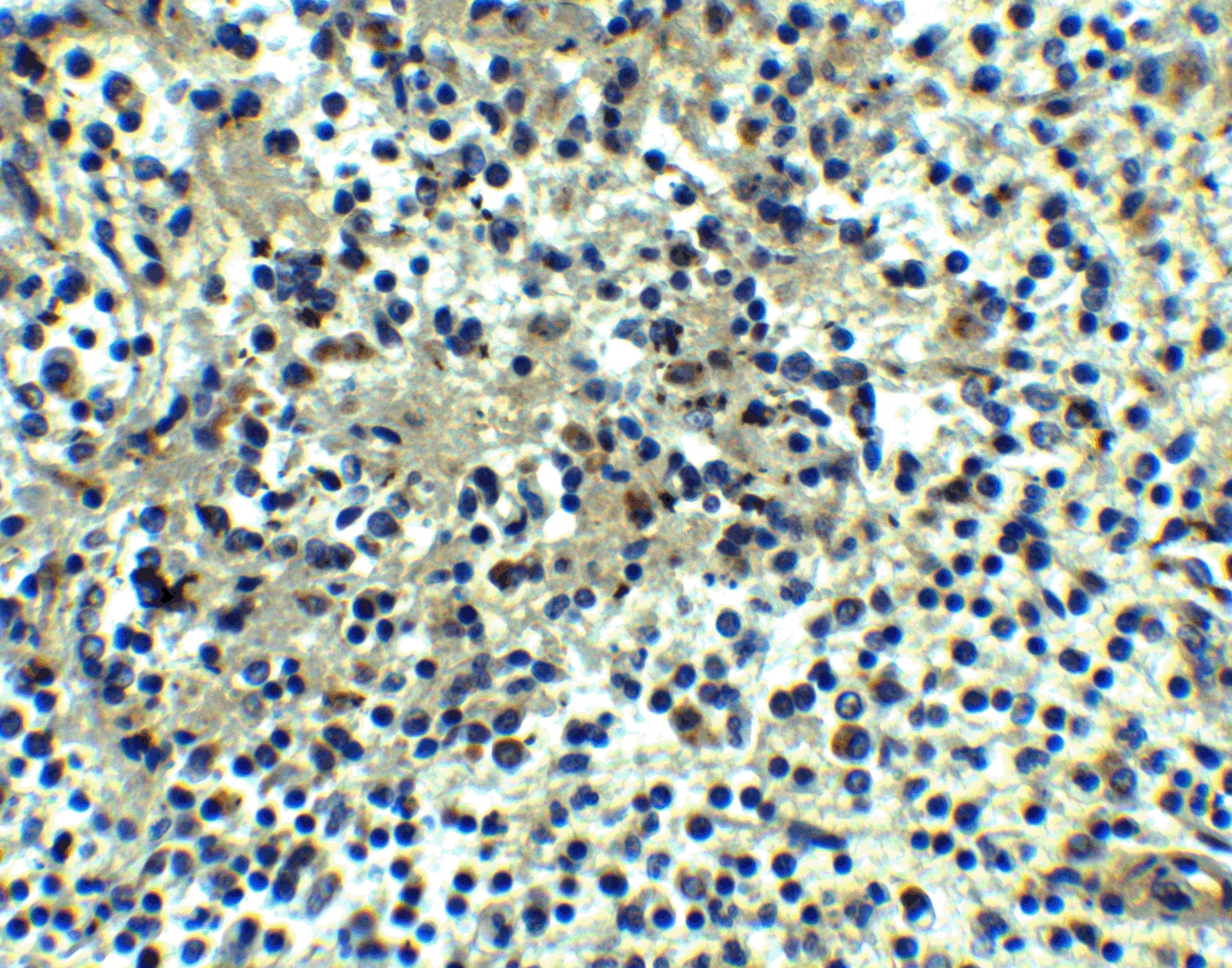 Immunohistochemistry: DEPDC1B Antibody - BSA Free [NBP2-81913] - Immunohistochemistry of DEPDC1B in human spleen tissue with DEPDC1B antibody at 5 u/ml.