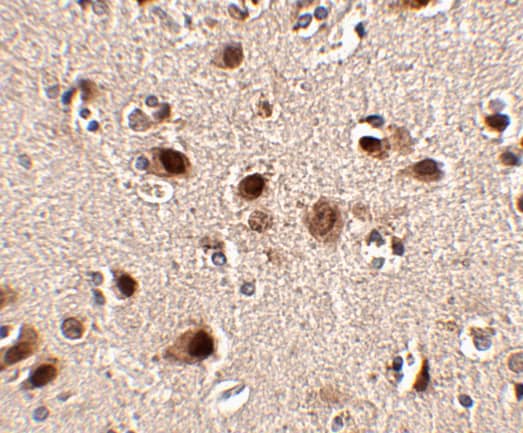 Immunohistochemistry: SLITRK5 Antibody - BSA Free [NBP2-81914] - Immunohistochemistry of Slitrk4 in human brain tissue with Slitrk4 antibody at 2.5 ug/mL.
