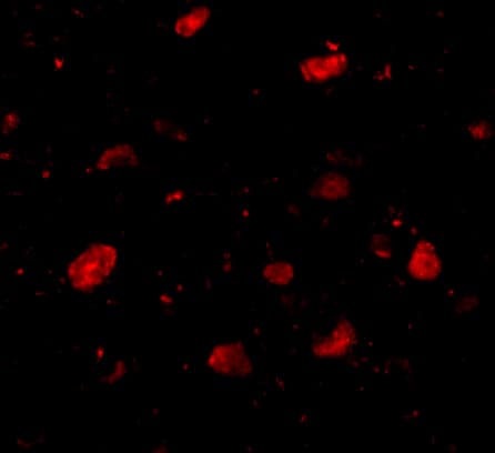 Immunocytochemistry/ Immunofluorescence: SLITRK5 Antibody - BSA Free [NBP2-81914] - Immunofluorescence of SLITRK5 in Human Brain cells with SLITRK5 antibody at 5 u/mL.