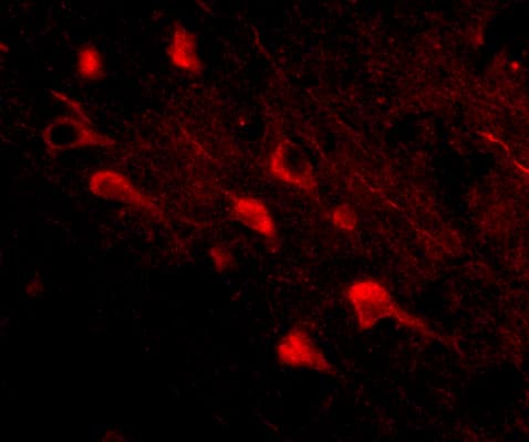 Immunocytochemistry/ Immunofluorescence SLITRK5 Antibody - BSA Free