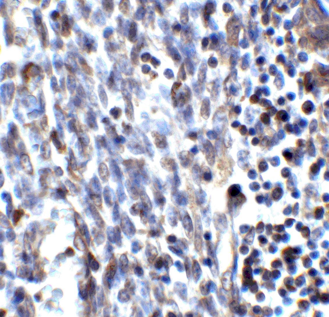 Immunohistochemistry SMURF2 Antibody - BSA Free