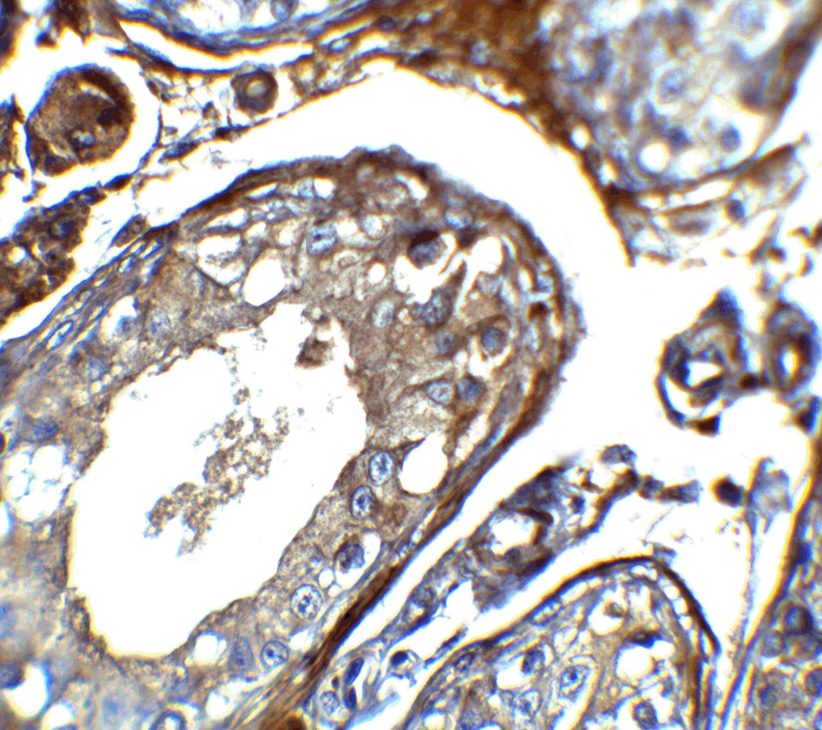 Immunohistochemistry: IQCF2 Antibody - BSA Free [NBP2-81922] - Immunohistochemistry of IQCF2 in human testis tissue with IQCF2 antibody at 5 ug/mL.