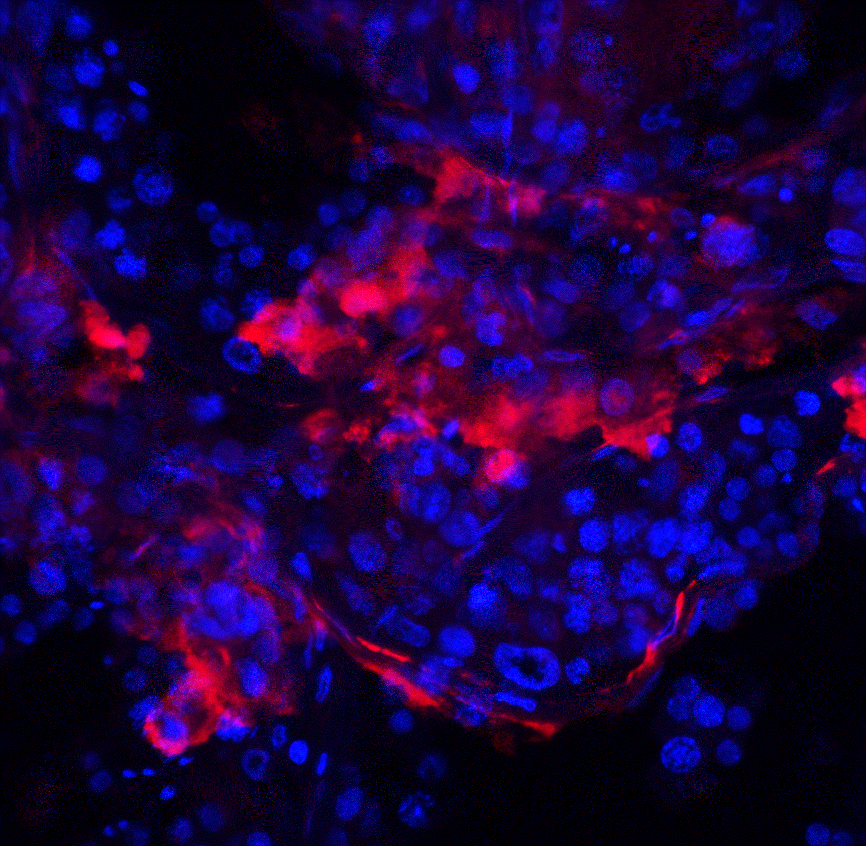Immunocytochemistry/ Immunofluorescence: IQCF2 Antibody - BSA Free [NBP2-81922] - Immunofluorescence of IQCF2 in human testis tissue with IQCF2 antibody at 20 ug/ml.Red: IQCF2 Antibody   Blue: DAPI staining