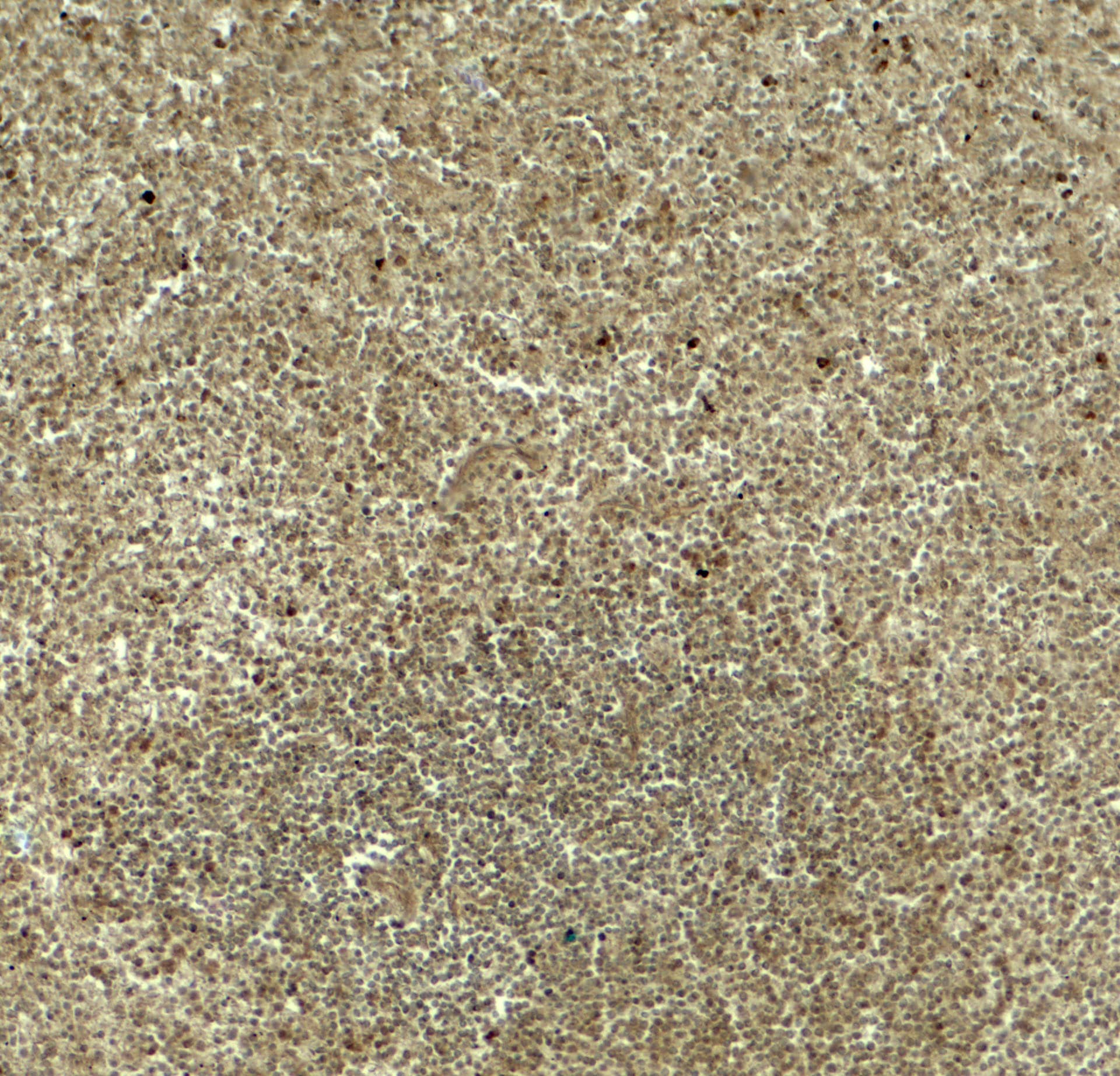 Immunohistochemistry DTX4 Antibody - BSA Free