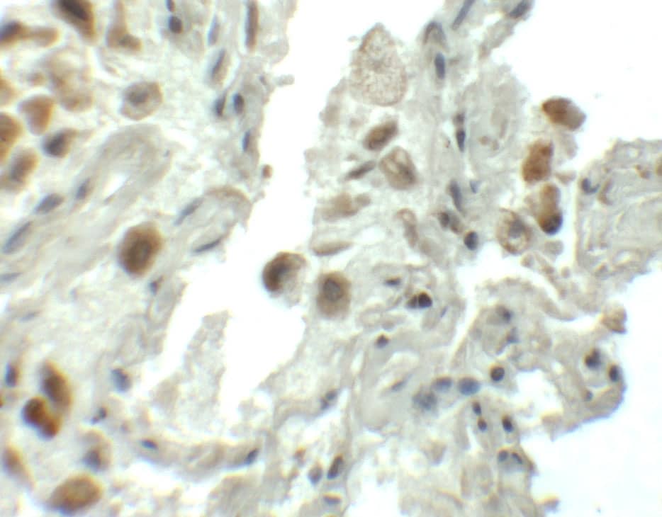 Immunohistochemistry: SPTLC1 Antibody - BSA Free [NBP2-81928] - Immunohistochemistry of SPTLC1 in human lung tissue with SPTLC1 antibody at 5 ug/mL.