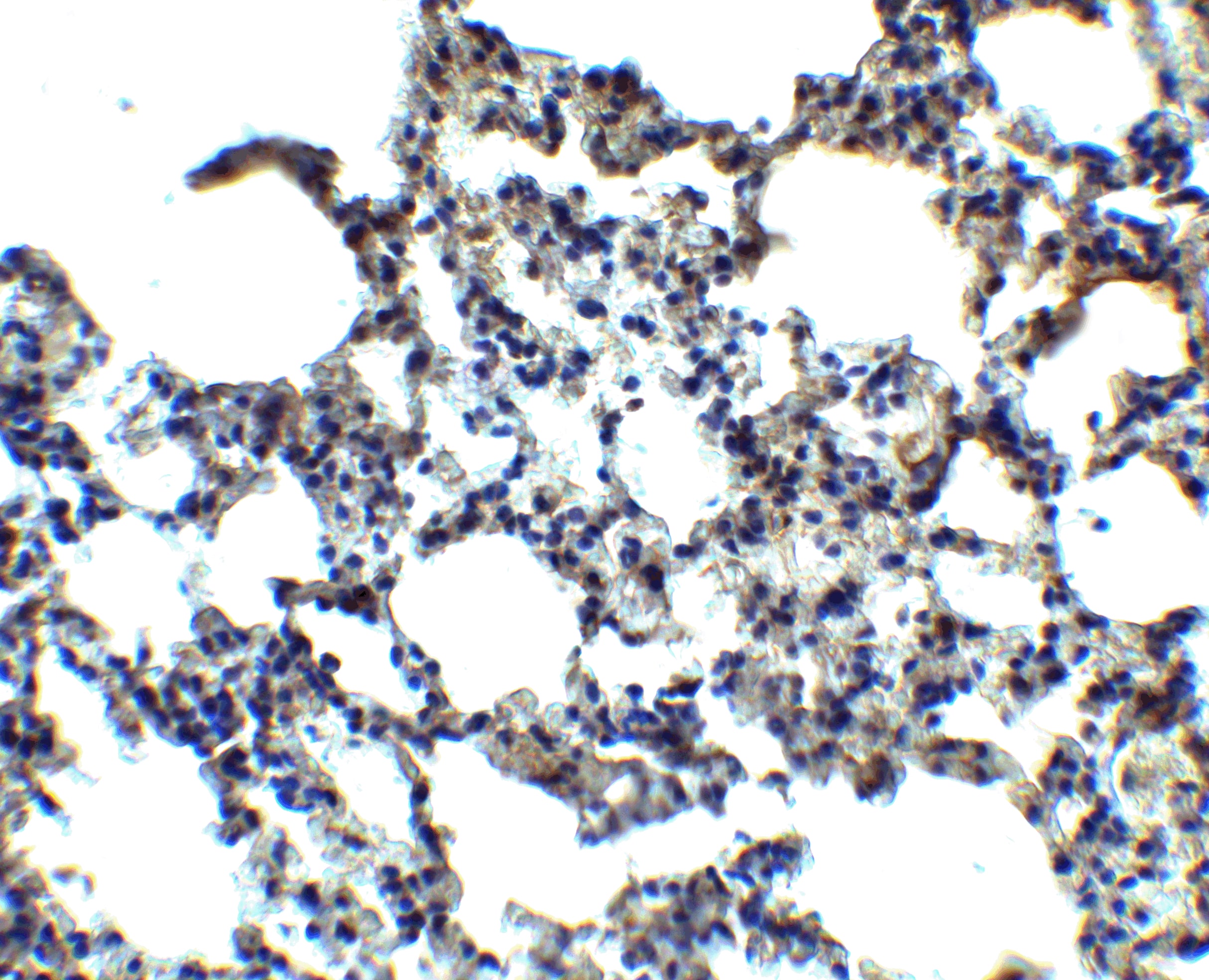 Immunohistochemistry MFSD2 Antibody - BSA Free