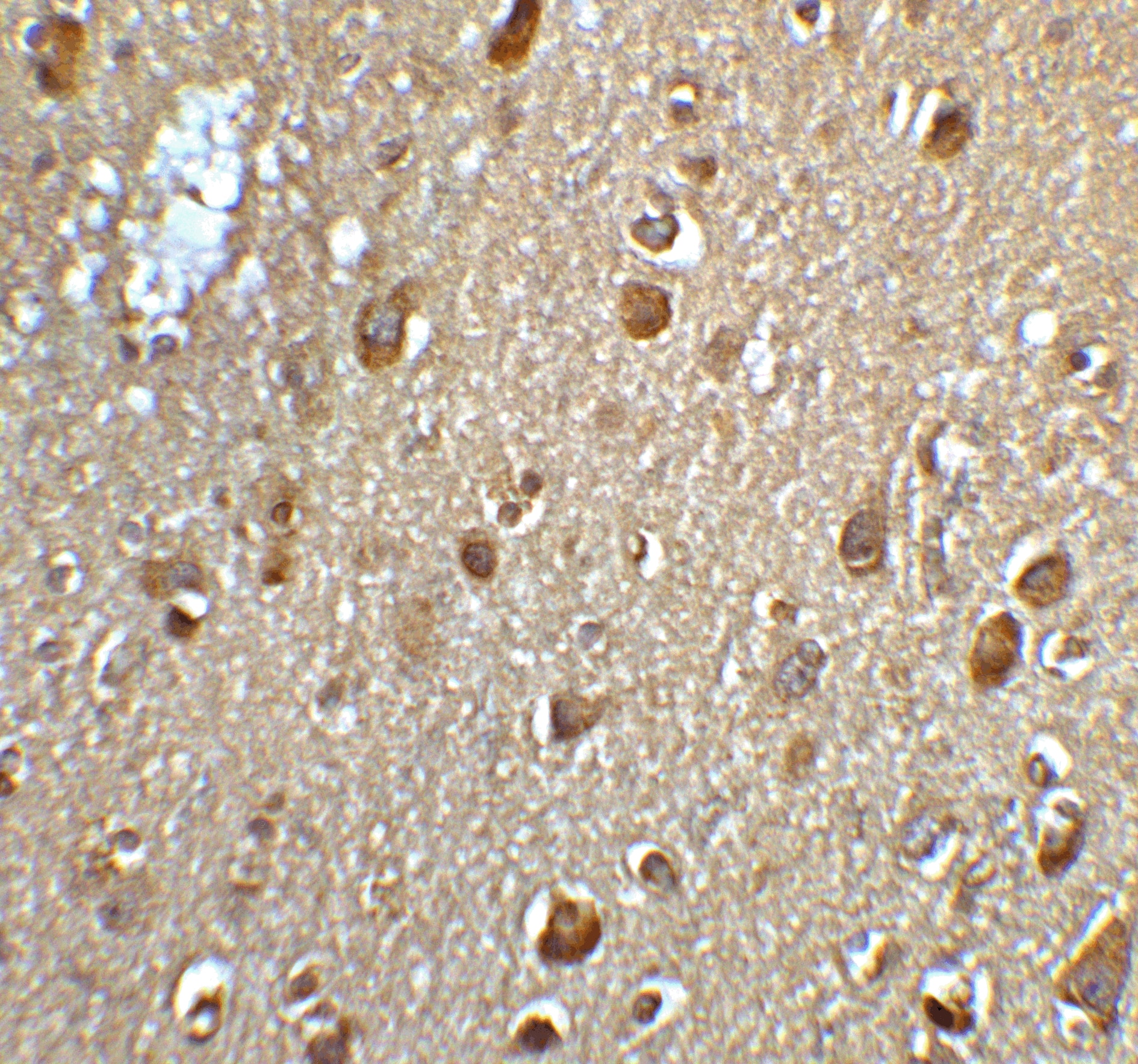 Immunohistochemistry: MFSD2 Antibody - BSA Free [NBP2-81929] - Immunohistochemistry of MFSD2 in human brain tissue with MFSD2 antibody at 5 ug/mL.