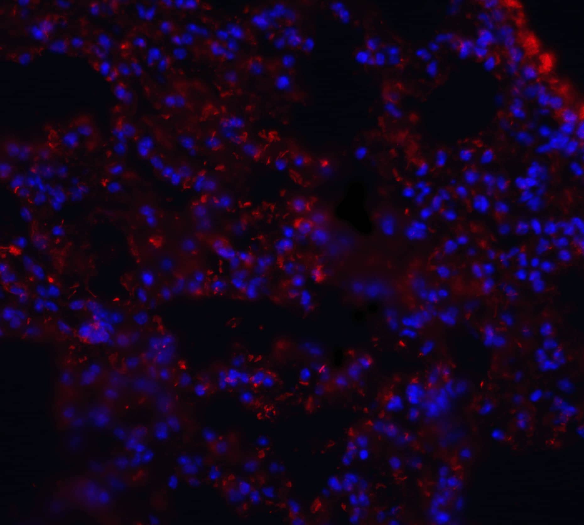 Immunocytochemistry/ Immunofluorescence: MFSD2 Antibody - BSA Free [NBP2-81929] - Immunofluorescence of MFSD2 in mouse lung tissue with MFSD2 antibody at 20 ug/mL.Red: MFSD2 Antibody   Blue: DAPI staining